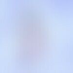 Bilharzia: egg from Schistosoma haematobium, the vital egg, recognizable by its transparency, has...