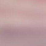 Ichthyosis vulgaris, autosomal-dominante. Retentionshyperkeratose mit nur gering ausgebildetem od...