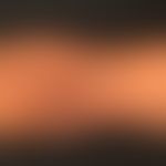 Kollagenose, reaktive perforierende. Gelenknahe, dissemnierte Anordnung der Läsionen. 
