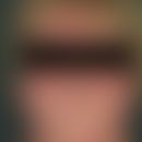 Dermatomyositis. Akut aufgetretenes heliotropes, sukkkulentes Exanthem; typische, ausgeprägte, sc...
