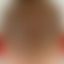 Behaarte Kopfhaut: normaler gleichmäßiger Haarbesatz.
