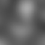 Laser Scanning Mikroskopie, Keratosis follicularis: In the centre of the picture the follicle fun...