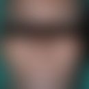 Lepra lepromatosa: fortgeschrittener Befund mit  zahlreichen , nahezu symmetrisch verteilten, asy...