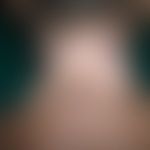 Vitiligo: Beginning spontaneous repigmentation

