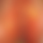 Behçet's syndrome: 31-year-old female patient with early symptoms of the disease in the vulva are...
