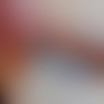 Hämatom, Nagelhämatom. Auflichtmikroskopie mit blauer, scharf begrenzter  Verfärbung des Nagels.
