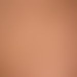 Lichen planus exanthematicus. itchy exanthema existing for about several months with barely pinhe...