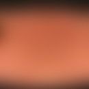 Hyperpigmentierung kalorische: seit mehreren Jahren unregelmäßige Wärmeanwendungen wegen Rückenbe...