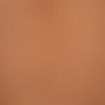 Lichen planus exanthematicus: detailed picture; small papular lichen planus with aggregation of e...