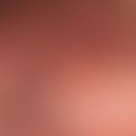 Syringome disseminated: (detailed view of the scrotum); since about 2 years, imperceptibly multip...