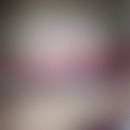 Prurigo-artiges Krankeitsbild unter Olmesartan, das zusammen mit den enteritischenSympotmen auftr...
