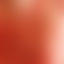 Pilomatrixkarzinom: Frau, 85 Jahre. Der Tumor wurde bioptiert, leider ohne eindeutigen Befund. Au...