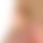 Synovialzyste (Ganglion): seit Jahren bestehender schmerzloser, prall-elastischer, subkutaner Tum...