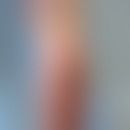 Dermatitis rheumatoide neutrophile: gruppierte, rot-braune Plaques und Knoten. Abb, entnommen aus...