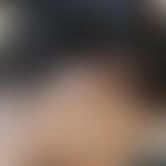 Pediculosis capitis: schwerer Kopflausbefall mit erheblicher "Ekzematisation" der Nackenregion. (...