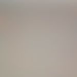 Muzinose multiple fokale kutane bei vorbekanntem systemischen Lupus erythematodes. Multiple muzin...