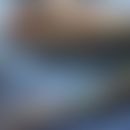 Anti-p200-Pemphigoid: Subepitheliale (kokardenförmige) Blasenbildungen bei einer 48-jährigen Pati...