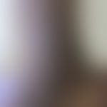 Podoconiosis: 85 Jahre alte Patientin aus Uganda. Chronische Podokoniose mit wachsartiger Verdick...