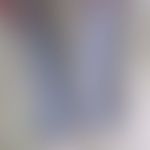 Podoconiosis: 85 Jahre alte Patientin aus Uganda. Chronische Podokoniose mit wachsartiger Verdick...