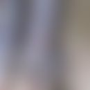 Podoconiosis:  85 Jahre alte Patientin aus Uganda. Chronische Podokoniose mit wachsartiger Verdic...